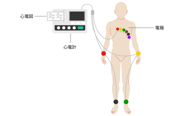 心電計と心電図のイメージ図